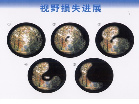 青障遮不住，“睛”彩每一天
