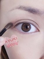 準分子激光手術