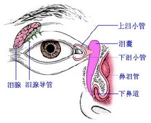 淚道堵塞的探通方法
