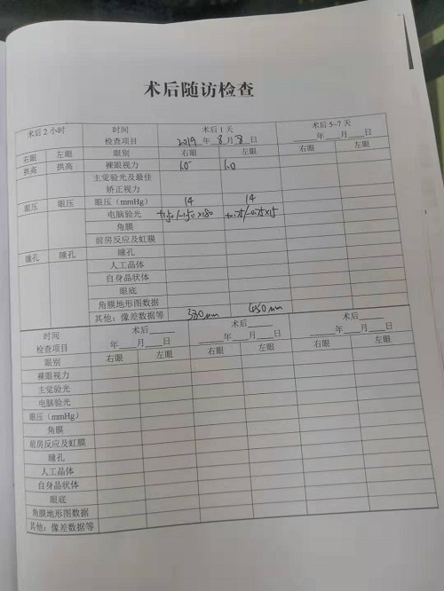 近視手術(shù)分享