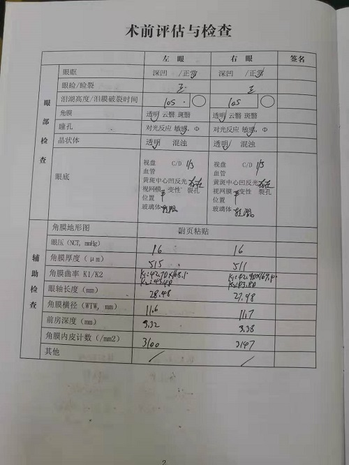 近視手術(shù)分享