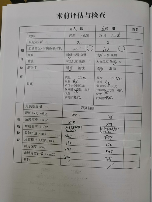 ICL晶體植入分享