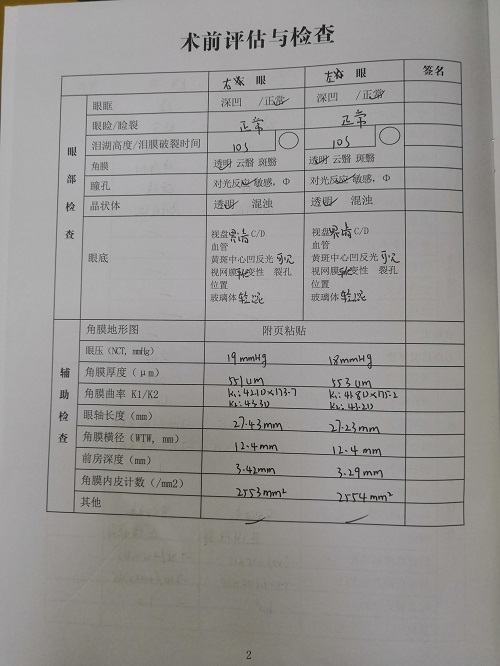 ICL晶體植入分享