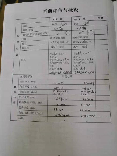ICL晶體植入分享