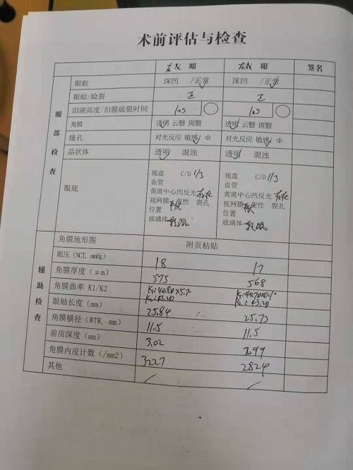 ICL晶體植入分享