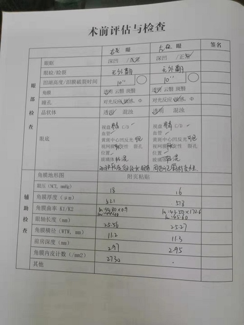 ICL晶體植入分享