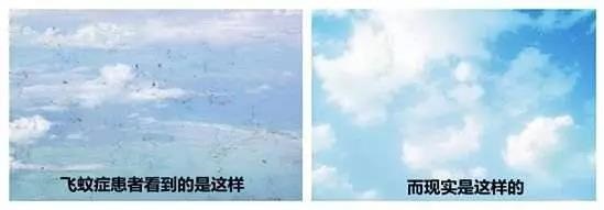 哪些人易患飛蚊癥？