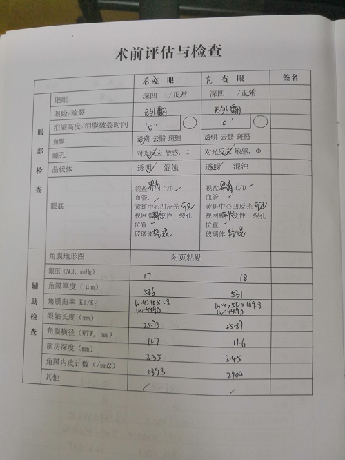 ICL晶體植入分享