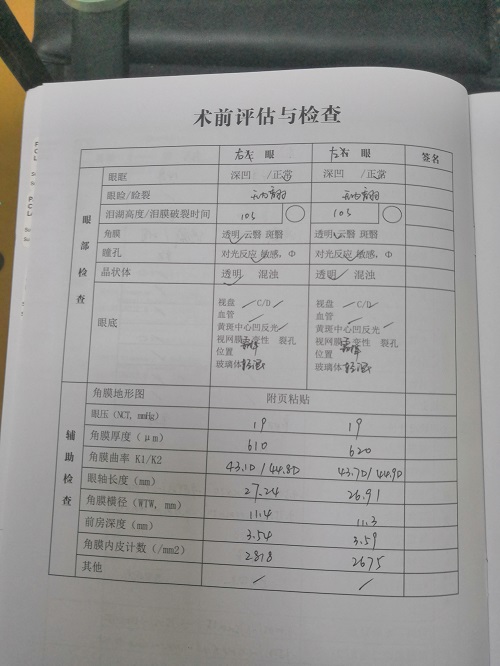 ICL晶體植入分享