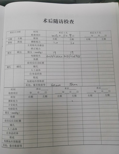 ICL晶體植入分享