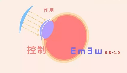 一副角膜塑形鏡可以戴多久？