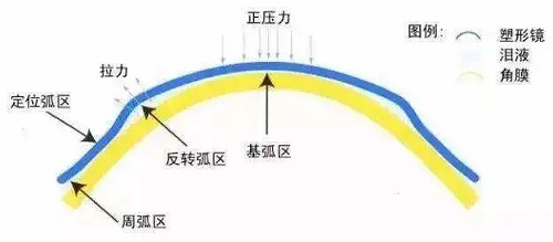 青少年配鏡，該選擇什么樣的框架？