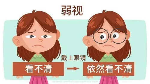 什么是弱視？