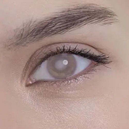 白內(nèi)障就是眼睛發(fā)白嗎？