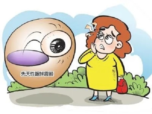 眼睛總晃個不停是眼球震顫嗎？