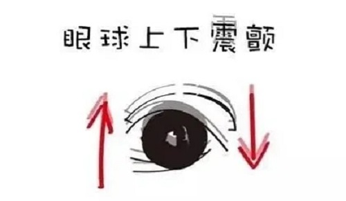 眼睛總是晃個不停是眼球震顫嗎？