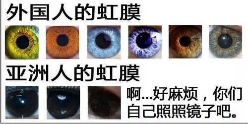 什么是虹膜異色癥？