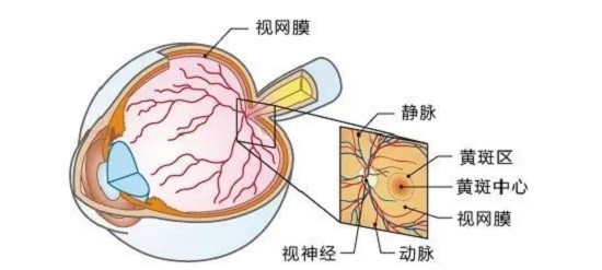 什么是老年性黃斑變性？
