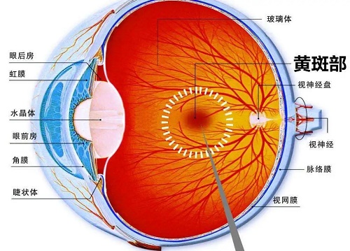 什么是黃斑病變？