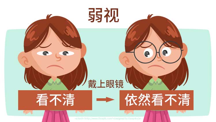 弱視